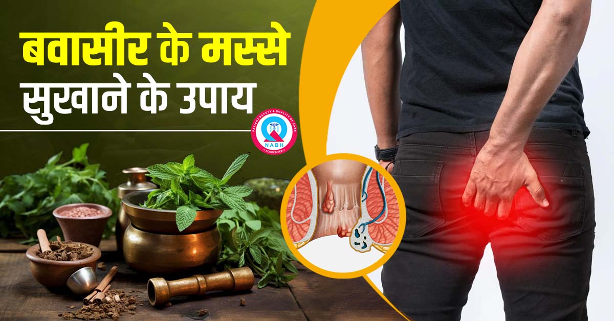 बवासीर के मस्से सुखाने के उपाय